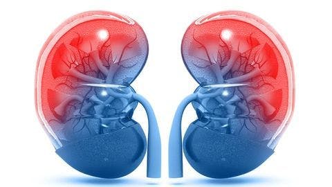Pembrolizumab plus lenvatinib boosts survival in frontline kidney cancer