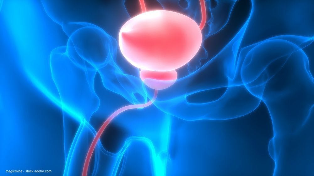 HoLEP improves outcomes in patients with LUTS related to benign prostatic enlargement