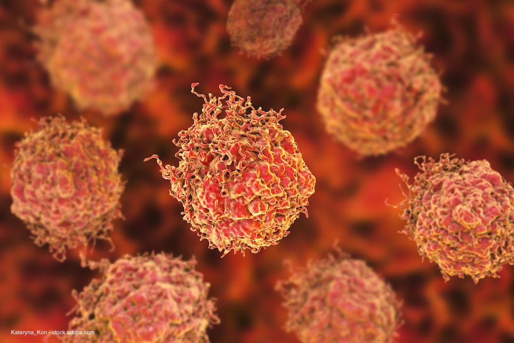 Circulating tumor cells are strong early signal of prostate cancer recurrence