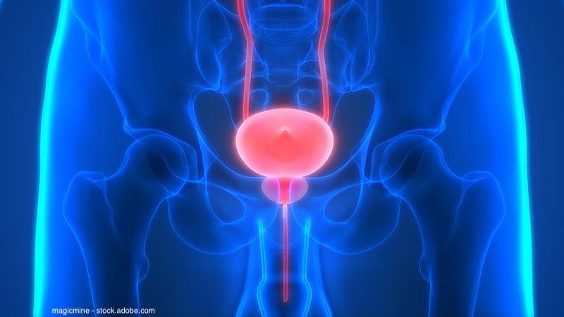 Enhancing  the use of adjuvant nivolumab in bladder cancer