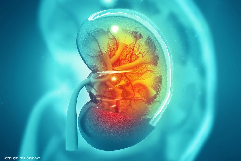 Cabozantinib hits high intracranial response rate in metastatic kidney cancer