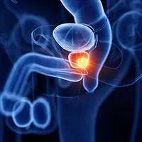 Metastatic Castration-Sensitive Prostate Cancer Treatment Updates