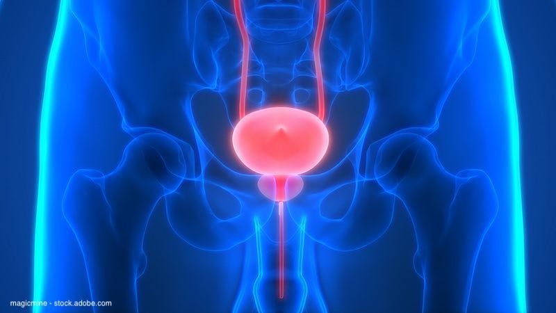 Artificial Intelligence enhances treatment assessment in bladder cancer