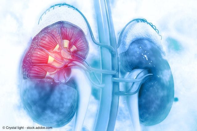 Cross section of human kidney | Image Credit: © Crystal light - stock.adobe.com
