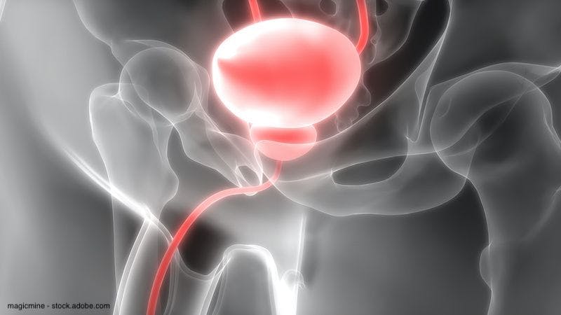 Enfortumab vedotin approved in Japan for bladder cancer