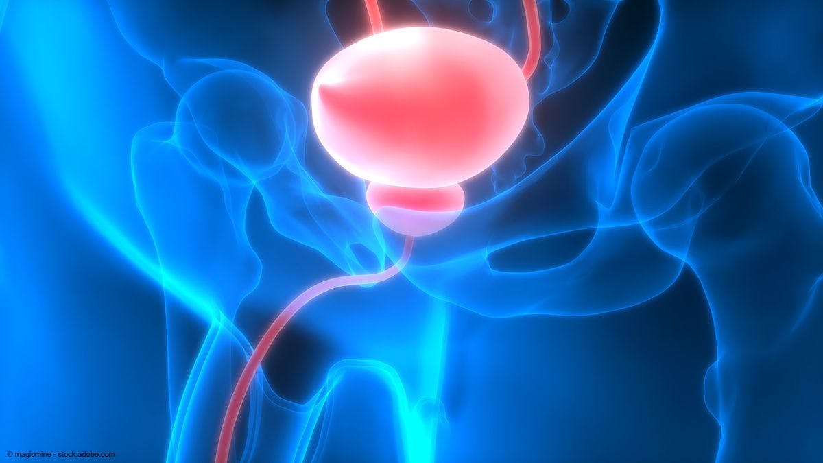 Blue light cystoscopy improves NMIBC detection in all racial groups