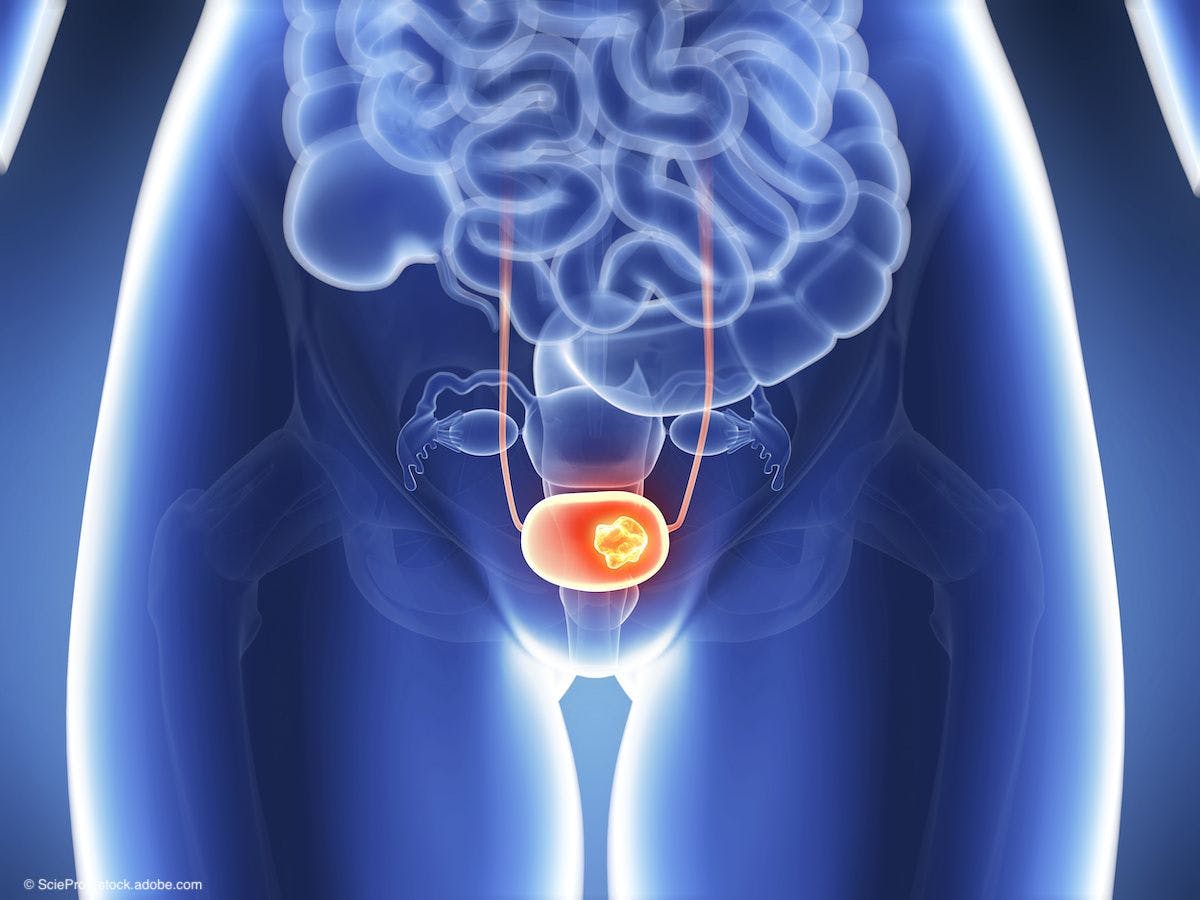 medical depiction of a human bladder on xray