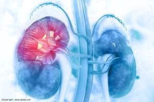 Enrollment completed for phase 3 trial of cabozantinib plus atezolizumab in renal cell carcinoma