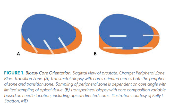 Biopsy Core Orientation