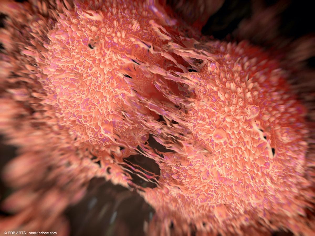 Prostate cancer cell dividing | Image Credit: © PRB ARTS - stock.adobe.com
