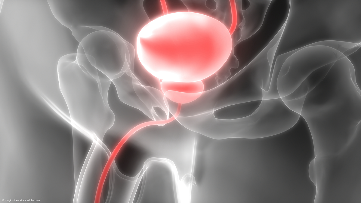medical depiction of a human bladder