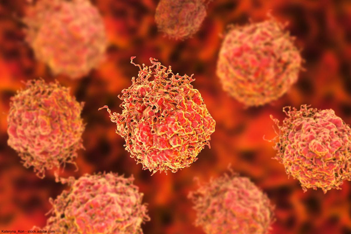 illustration of prostate cancer cells