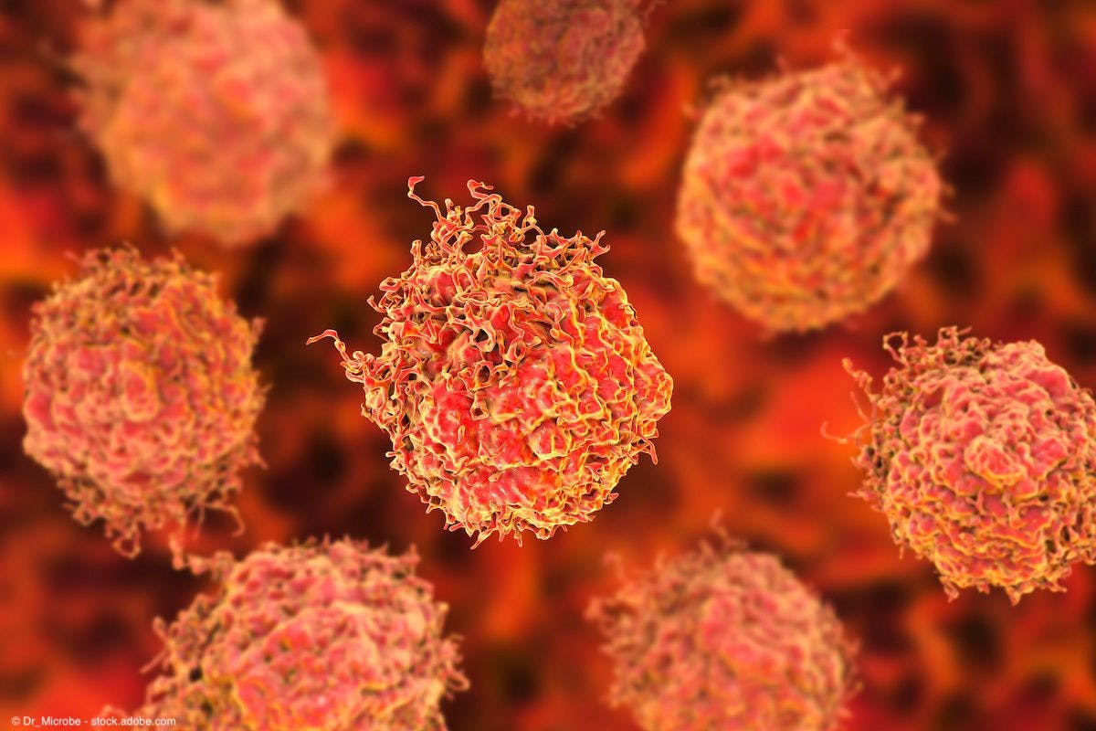 Prostate cancer cells, 3D illustration | Image Credit: © Dr_Microbe - stock.adobe.com