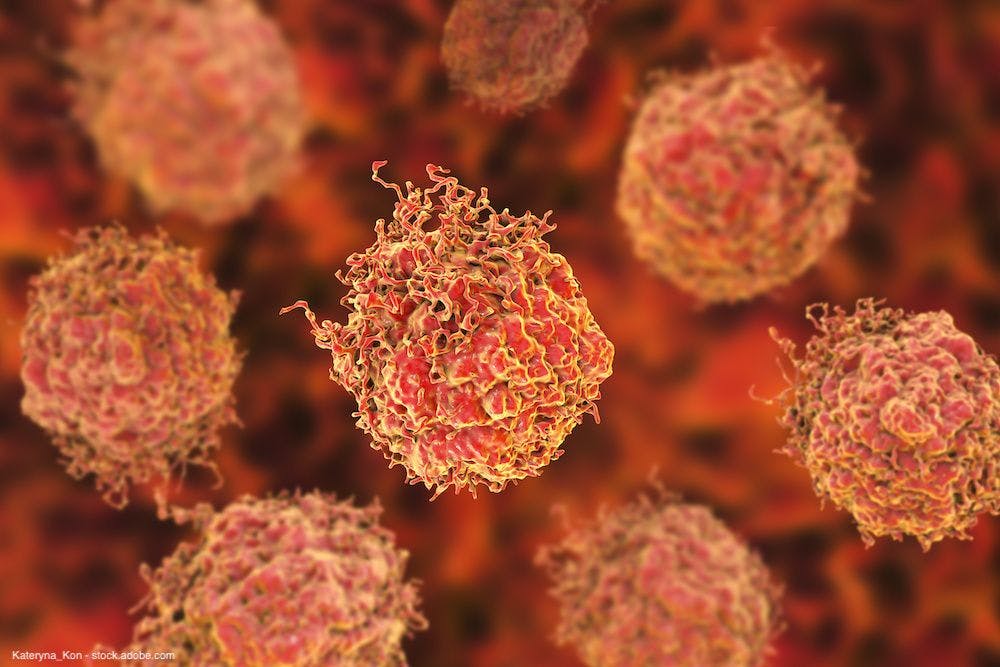 PSMA targeted CAR T-cell therapy shows antitumor activity in mCRPC