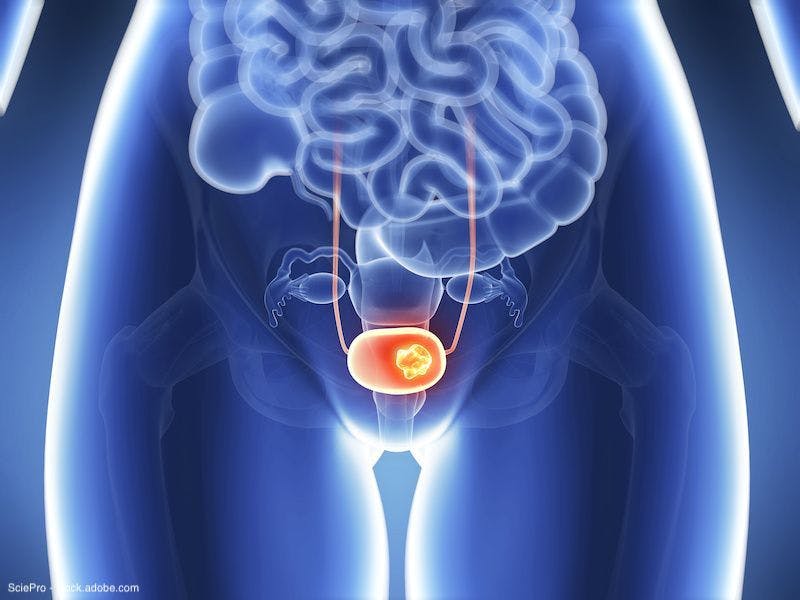 Topline results reported for pembrolizumab/enfortumab vedotin combo in bladder cancer