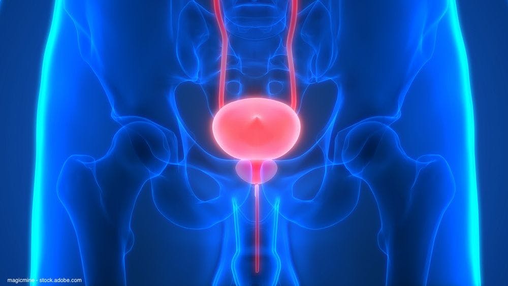 Dr. Parminder Singh discusses bladder-sparing immunotherapy-based approach in MIBC