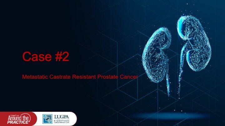 Metastatic Castrate Resistant Prostate Cancer
