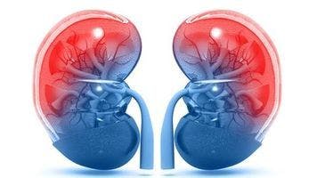 Study supports active surveillance for younger patients with small renal masses