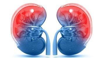 Study supports post-immunotherapy cabozantinib for metastatic kidney cancer