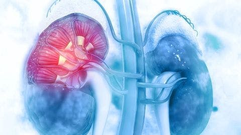 QoL boost linked to higher lenvatinib dose in kidney cancer