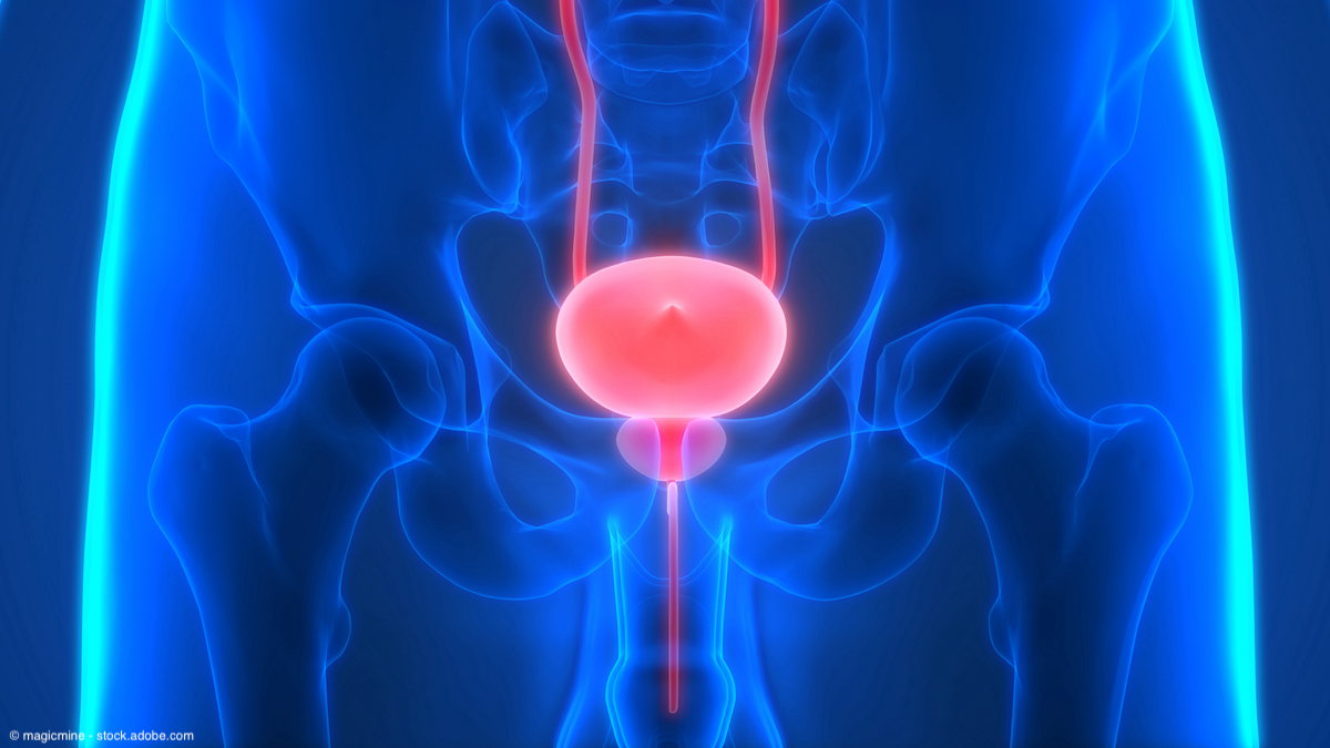 blue xray of human bladder
